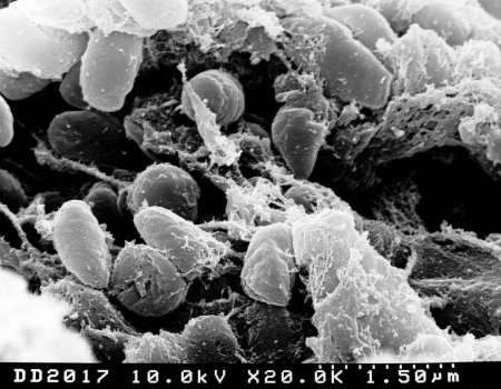 Plague (Yersinia pestis)